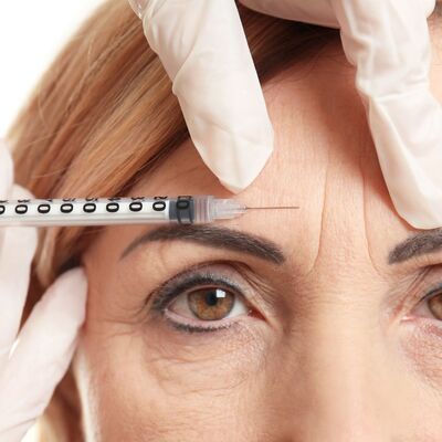 FROWN LINES FILLER ROCHESTER MN