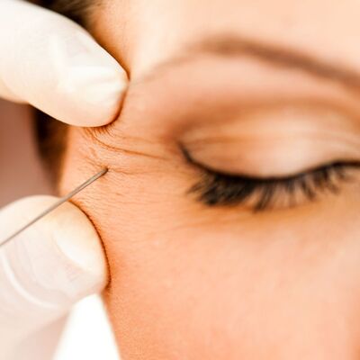 FILLER AND BOTOX ROCHESTER MN